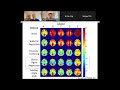 resting state global brain activity controversies hypotheses and discovery