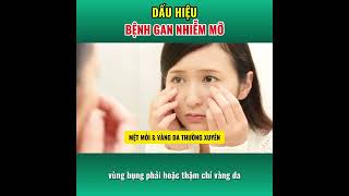 90% NGƯỜI BỊ GAN NHIỄM MỠ KHÔNG BIẾT MÌNH MẮC | Bác sĩ Trang