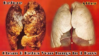 सिर्फ  3 दिन  में फेफड़ों को साफ करके धूम्रपान के प्रभाव को ख़त्म करें | Lungs Detox For Smokers