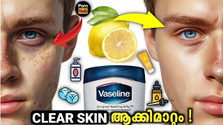 Skinnmaxxing Malayalam | lookmaxing 2/30-(clear skin)