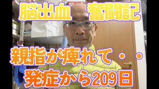 脳出血　後遺症奮闘記　なんで腕がしびれるのか