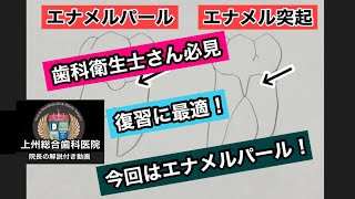 第１４回　エナメルパール　上州総合歯科医院　歯科衛生士　スケーリング　SRP　基本講座　スケーリングの方法　Dental　Hygiene　歯科衛生士向け動画