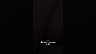 The Enigma of Adermatoglyphia: Unraveling the Mystery of Missing Fingerprints