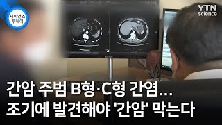 간암 주범 B형·C형 간염…조기에 발견해야 '간암' 막는다 / YTN 사이언스