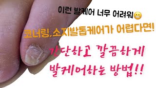 소지발톱, 코너링 패디케어가 어렵다면! 꼭 보세요! |나만 알고싶은 발케어방법|