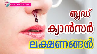 ബ്ലഡ് ക്യാൻസർ ലക്ഷണങ്ങൾ |Blood cancer symptoms |  Ethnic Health Court