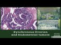 Synchronous Ovarian and Endometrial Tumors