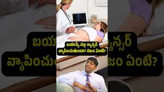 బయాప్సీ వల్ల క్యాన్సర్ వ్యాపించుతుందా?  | Dr.Chinnababu Sunkavalli | For Appointment: 9000126776