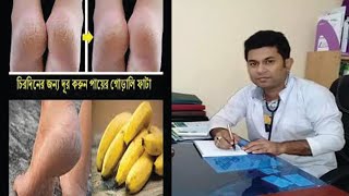 পাকা কলা ব্যবহার করে পা ফাটা থেকে সহজে মুক্তি পান