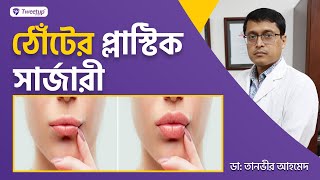 ঠোঁটের প্লাস্টিক সার্জারি । । Lip Plastic Surgery