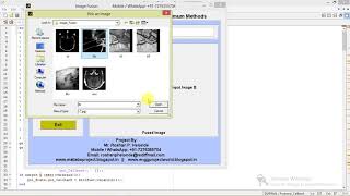 Image Fusion Using Matlab Code