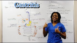 Medical Surgical Gastrointestinal System: Gastritis