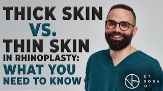 Thick Skin vs Thin Skin: The Rhinoplasty Showdown