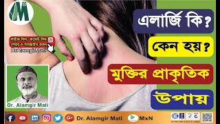 What are allergies? Natural way to get rid of allergies এলার্জি কি? কেন হয়, মুক্তির প্রাকৃতিক উপায়