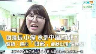 【名醫大聲公】 眼睛周圍長小瘤，竟是中風前兆？這些「眼部」症狀出現 需快就醫