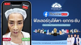 รีวิวจากคนไข้จริง - คุณวรรณดี ฉีดฟิลเลอร์แก้ปัญหาถุงใต้ตา และยกกระชับ กับอาจารย์หมอเมฆ