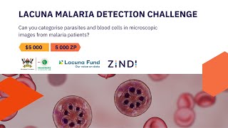 Lacuna Malaria Detection Challenge Webinar