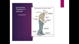 Lifespan Ch 24 Dementia