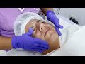 rejuvenecimiento facial con plasma rico en plaquetas