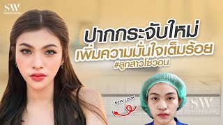 ปากกระจับสวยมั่นใจเกินร้อย  | รีวิวลูกสาวหมอ Sowon clinic ep.322