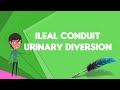 What is Ileal conduit urinary diversion?, Explain Ileal conduit urinary diversion