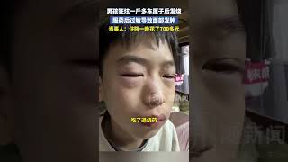 男孩狂炫一斤多車厘子后發燒，服藥后過敏導致面部發腫，當事人：住院一晚花了700多元