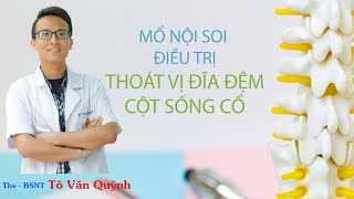 MỔ NỘI SOI ĐIỀU TRỊ THOÁT VỊ ĐĨA ĐỆM CỘT SỐNG CỔ