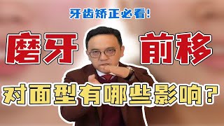 牙套党矫正必看！磨牙前移会对面型有哪些影响？