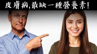 皮膚炎等皮膚問題，都缺一種營養素？自然療法,柏格醫生 Dr Berg