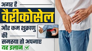 अगर है वैरीकोसेल और कम शुक्राणु की समस्या तो अपनाए यह इलाज  | varicocele vs sperm count | Dr. Health