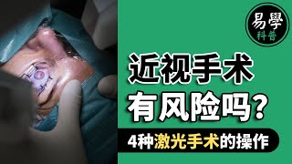 4种近视手术的操作