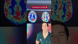 How Caffeine Really Affects The Brain