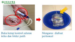 腹膜透析換液技術mp4  印尼版