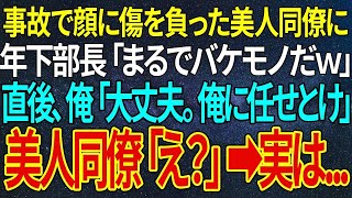 【感動する話】事故で顔に傷を負った美人同僚に年下部長「まるでバケモノだｗ」直後、俺「大丈夫。俺に任せとけ」美人同僚「え？」➡実は【朗読】【 泣ける話】【 良い話】