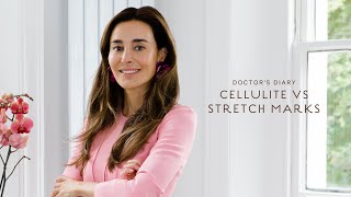 DOCTOR'S DIARY: CELLULITE VS STRETCH MARKS