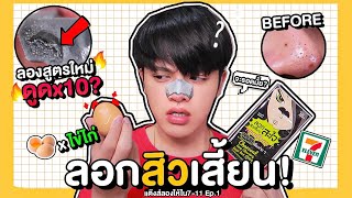 รีวิวพลีชีพ! แผ่นลอกสิวเสี้ยน+ไข่ขาว พลังดูดx10 สองอย่างมาเจอกัน! อย่าหาทำ มีคำเตือน!! lSuperthankky