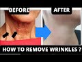 FACE YOGA FOR NECK WRINKLES | GET RID OF NECK LINES | TURKEY NECK | FACE MASSAGE FOR WRINKLES