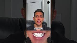 Difference of a good veneers and a bad veneer (Part 1)