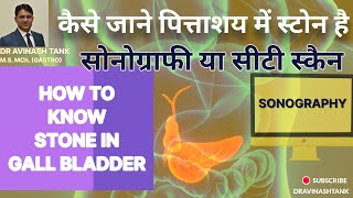 3.कैसे जाने पित्ताशय में स्टोन है या नहीं HOW TO KNOW STONE IN GALL BLADDER. SONOGRAPHY OR CT SCAN?