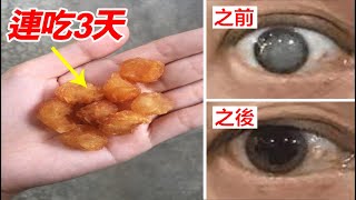 這種果子連續吃3天，恢復眼球清澈，白內障、老花眼都不见了！