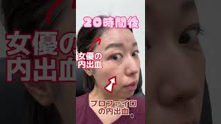 女優注射：ポリヌクレオチドを有効成分とし、肌の根本部分から若返り・お肌の自己再生を促す注射です。リスク：疼痛・腫れ・内出血・血管閉塞・アレルギー・感染・硬結など。価格：49,800円