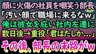 【感動する話】顔に火傷がある陰キャ社員を見下す上司「化粧くらいしろバケモノがw」彼女を庇った俺は窓際部署に社内左遷させられた。ある日→会社の重役が視察に来ると「君は確か…」俺「あ！」【泣ける話】