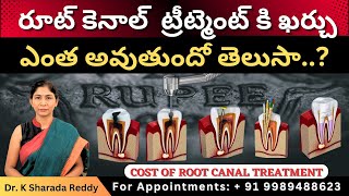 Cost of Root Canal Treatment | by Dr. K Sharada Reddy in telugu #shockingfacts #dentistry