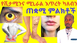 የቪታሚንና ሚኒራል እጥረት ሰውነታችን ላይ መኖሩን ጠቋሚ አይነተኛ ምልክቶች Vitamin and Mineral deficiency typical signs.