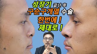 30화. 구순구개열 수술 한번에! 제대로! l 원(장)님에게 물어봐