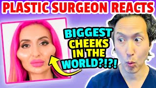 Plastic Surgeon Reacts to LARGEST Cheeks in the World! EXTREME Bodies EXPLAINED!