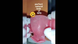 RPD🤩"MAGIC"☺😃😍#youtubeshorts #dental #rpd #smile