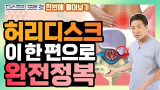 디스크 탈출, 디스크 파열, 섬유륜 파열! 허리 디스크에 대한 모든 정보를 다 모았다! - 이경석의 척추88 허리 디스크 몰아보기