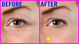 Wrinkles Under Your Eye Massage | Greatest Face Exercise Feel Like | Yoga |  បាត់ជ្រួញជុំវិញភ្នែក