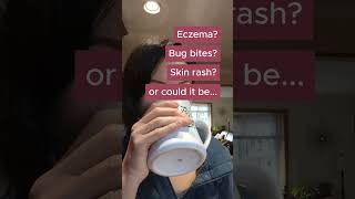 Is Your Skin Rash Actually SHINGLES?! 😱 #shorts